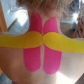 Kinesio Taping